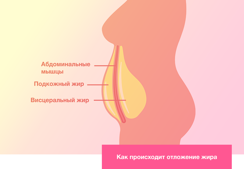 Как происходит отложение жира